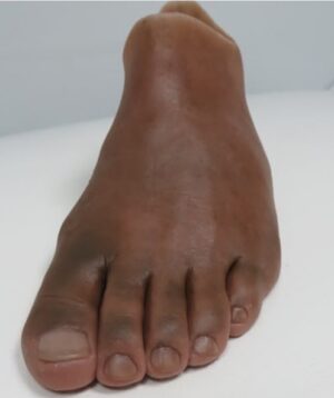 Full Foot Silicone Prosthesis