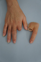 A custom-crafted, three-finger silicone prosthesis resting on a grey surface. The piece features a wide, tapered base designed for partial hand amputations, complete with highly realistic skin textures, knuckles, and fingernails.
